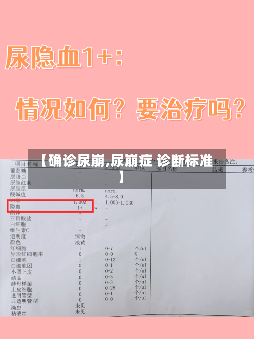 【确诊尿崩,尿崩症 诊断标准】-第2张图片