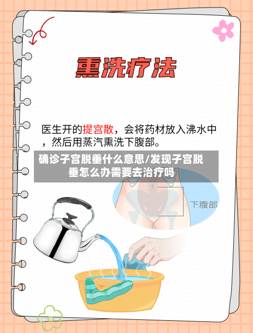 确诊子宫脱垂什么意思/发现子宫脱垂怎么办需要去治疗吗
