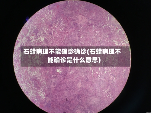 石蜡病理不能确诊确诊(石蜡病理不能确诊是什么意思)